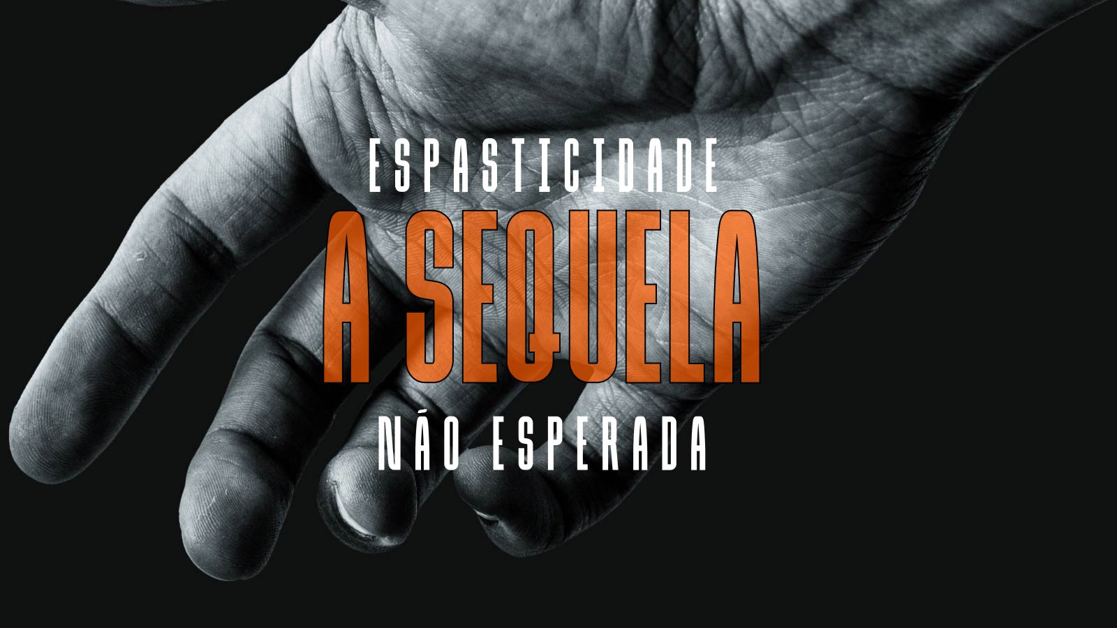 ESPASTICIDADE A SEQUELA NÃO ESPERADA